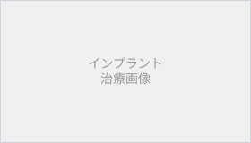 入れ歯・ブリッジ
