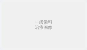 一般歯科・根管治療